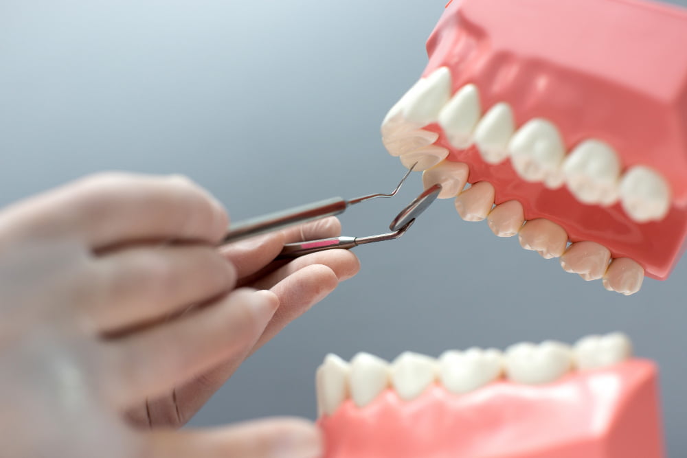 Prótese protocolo: Fixação, tipos e preço 4 dentes protese