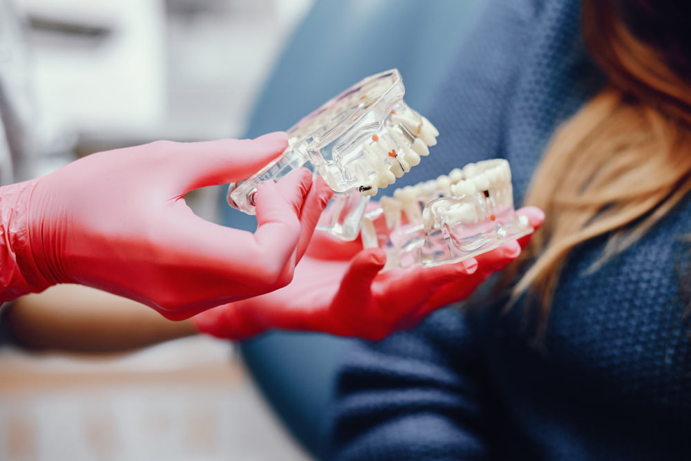Prótese protocolo: Fixação, tipos e preço 1 protese protocolo 1